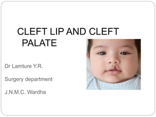 Dr Lamture Y.R.
Surgery department
J.N.M.C. Wardha
CLEFT LIP AND CLEFT
PALATE
 