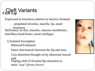 Cleft lip and palate ----- | PPTX