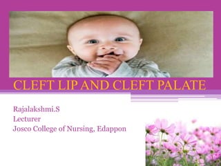 CLEFT LIP AND CLEFT PALATE
Rajalakshmi.S
Lecturer
Josco College of Nursing, Edappon
 