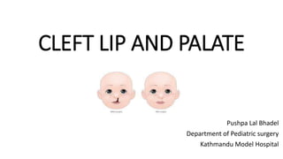 CLEFT LIP AND PALATE
Pushpa Lal Bhadel
Department of Pediatric surgery
Kathmandu Model Hospital
 