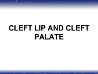 CLEFT LIP AND CLEFT
PALATE
 