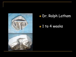  Dr. Ralph Latham
 1 to 4 weeks
 