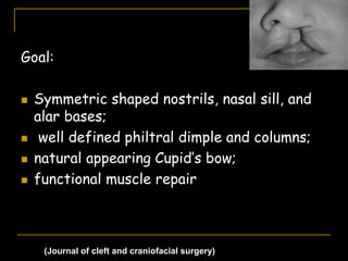 Goal:
 Symmetric shaped nostrils, nasal sill, and
alar bases;
 well defined philtral dimple and columns;
 natural appearing Cupid’s bow;
 functional muscle repair
(Journal of cleft and craniofacial surgery)
 