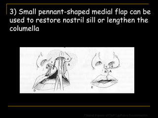 Clinical Aspects of Cleft Lip/Palate Reconstruction
3) Small pennant-shaped medial flap can be
used to restore nostril sill or lengthen the
columella
 