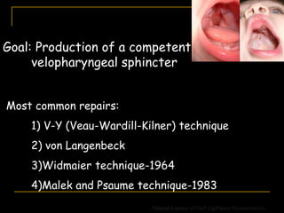 Goal: Production of a competent
velopharyngeal sphincter
Most common repairs:
1) V-Y (Veau-Wardill-Kilner) technique
2) von Langenbeck
3)Widmaier technique-1964
4)Malek and Psaume technique-1983
Clinical Aspects of Cleft Lip/Palate Reconstruction
 