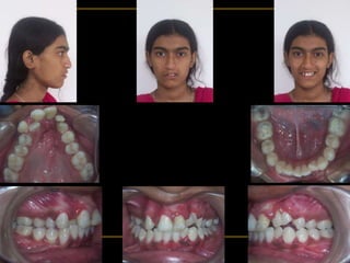 RAKSHA AFSARI
15/F
2727
PRE-TREATMENT
 