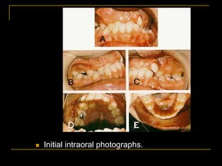  Initial intraoral photographs.
 