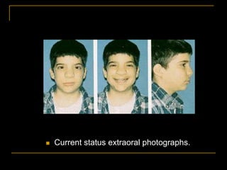  Current status extraoral photographs.
 