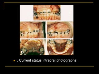  . Current status intraoral photographs.
 