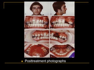  Posttreatment photographs
 