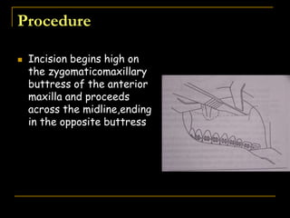 Procedure
 Incision begins high on
the zygomaticomaxillary
buttress of the anterior
maxilla and proceeds
across the midline,ending
in the opposite buttress
 