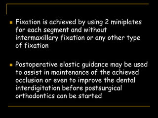  Fixation is achieved by using 2 miniplates
for each segment and without
intermaxillary fixation or any other type
of fixation
 Postoperative elastic guidance may be used
to assist in maintenance of the achieved
occlusion or even to improve the dental
interdigitation before postsurgical
orthodontics can be started
 