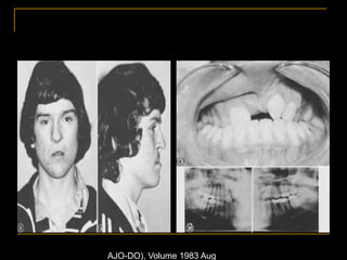 AJO-DO), Volume 1983 Aug
 