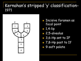 Kernahan’s stripped ‘y’ classification-
1971
 Incisive foramen as
focal point
 1,4-lip
 2,5-alveolus
 3,6-Hp ant to IF
 7,8-Hp post to If
 9-soft palate
 