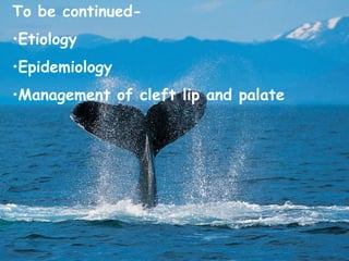 To be continued-
•Etiology
•Epidemiology
•Management of cleft lip and palate
 