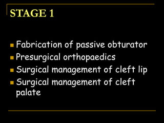 STAGE 1
 Fabrication of passive obturator
 Presurgical orthopaedics
 Surgical management of cleft lip
 Surgical management of cleft
palate
 