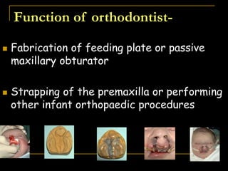  Fabrication of feeding plate or passive
maxillary obturator
 Strapping of the premaxilla or performing
other infant orthopaedic procedures
Function of orthodontist-
appliance.
appliance.
 