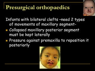 Infants with bilateral clefts –need 2 types
of movements of maxillary segment-
 Collapsed maxillary posterior segment
must be kept laterally
 Pressure against premaxilla to reposition it
posteriorly
Presurgical orthopaedics
 