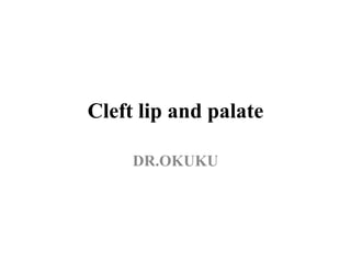 Cleft lip and palate
DR.OKUKU
 