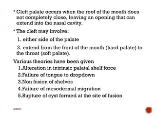 A brief overview of Cleft Lip and Palate.ppt