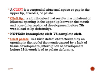 A brief overview of Cleft Lip and Palate.ppt