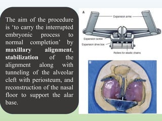CLEFT LIP AND PALATE orthodontics. .pptx