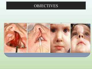 CLEFT LIP AND PALATE orthodontics. .pptx