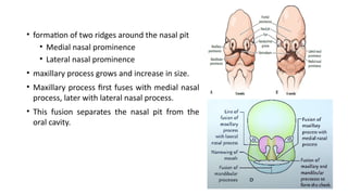 Two Ridges cleft lip and palate diagnosis and treatment modalities | PPTX