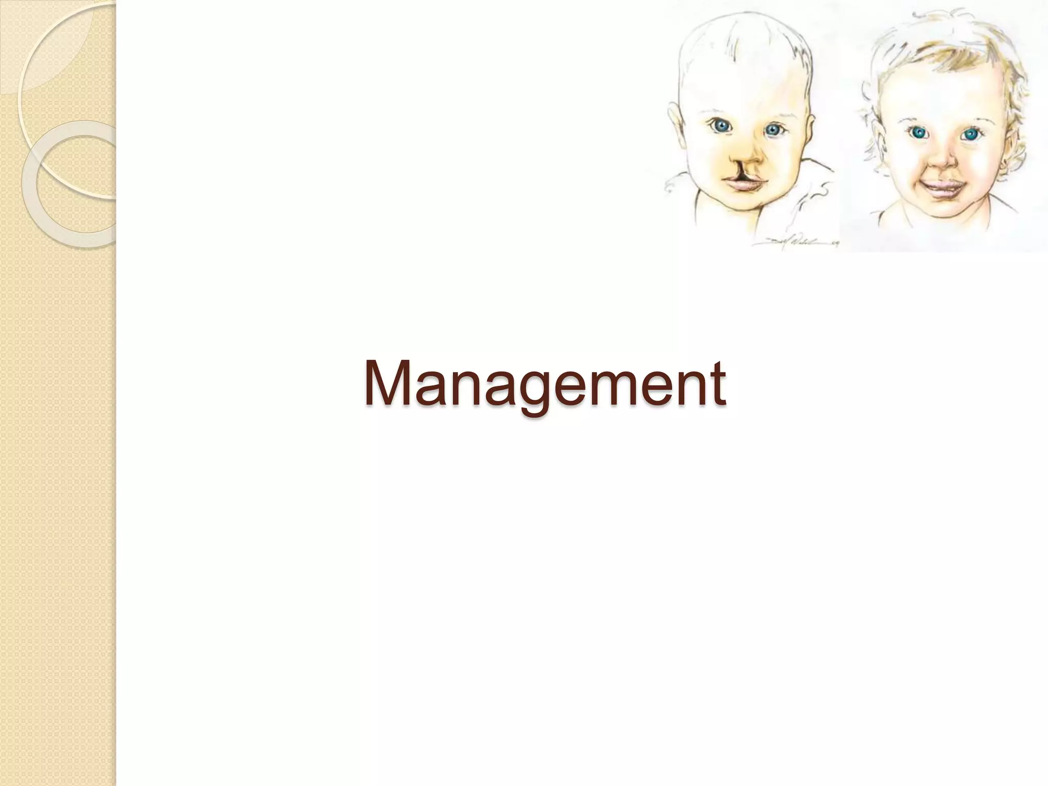 Management
 