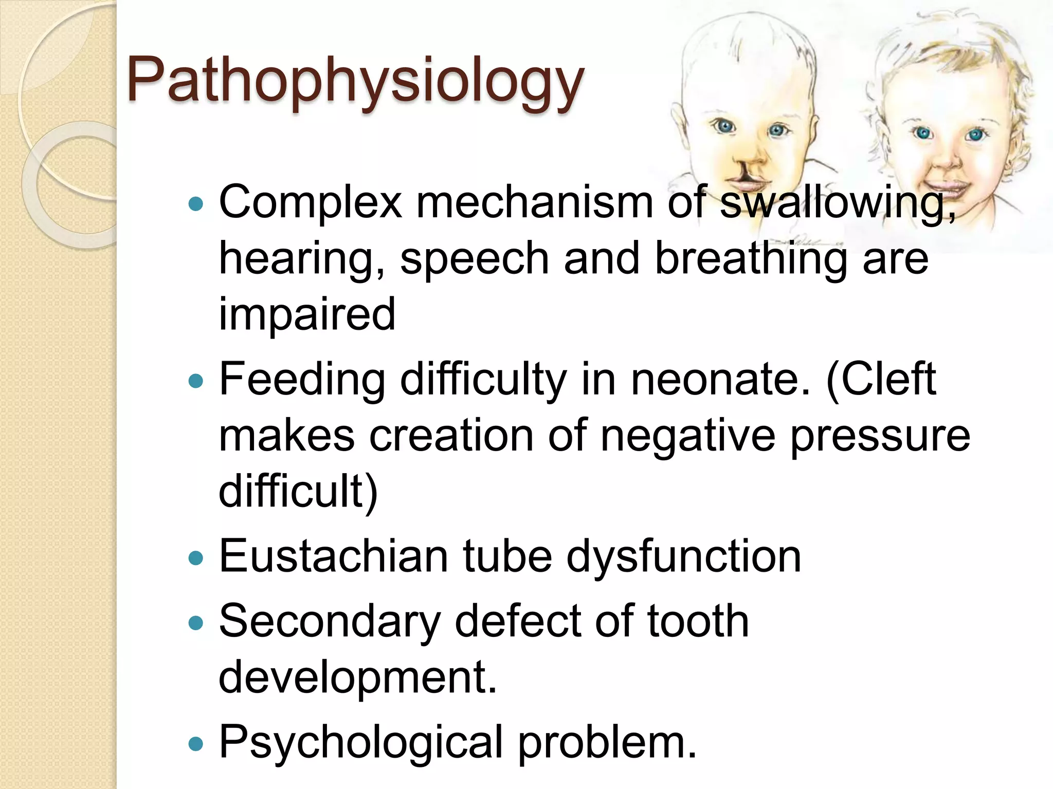 Pathophysiology
 Complex mechanism of swallowing,
hearing, speech and breathing are
impaired
 Feeding difficulty in neonate. (Cleft
makes creation of negative pressure
difficult)
 Eustachian tube dysfunction
 Secondary defect of tooth
development.
 Psychological problem.
 
