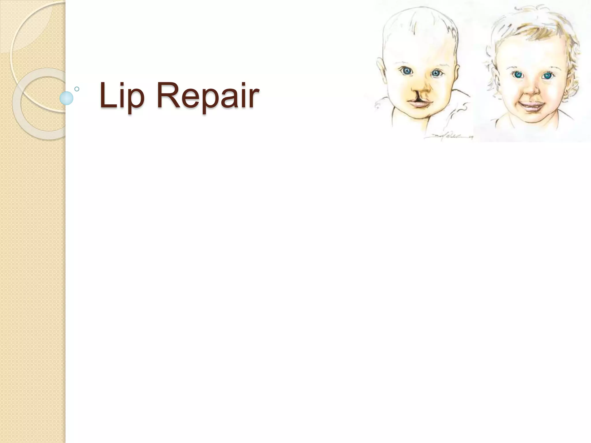 Lip Repair
 