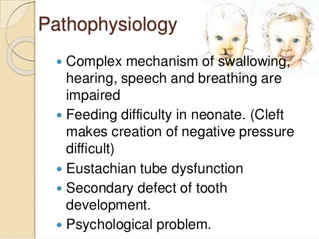 Cleft Lip And Palate Basics