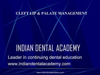 CLEFT LIP & PALATE MANAGEMENT

INDIAN DENTAL ACADEMY
Leader in continuing dental education
www.indiandentalacademy.com
www.indiandentalacademy.com

 