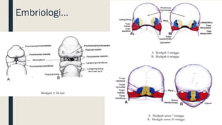 Cleft lip and palate | PDF