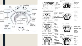 Cleft lip and palate | PDF