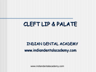 CLEFT LIP & PALATE


 INDIAN DENTAL ACADEMY
www.indiandentalacademy.com



   www.indiandentalacademy.com
 