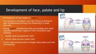 Cleft lip and palate and its management | PPTX