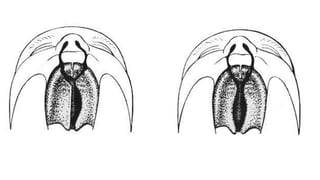 CLEFT LIP AND PALATE ETIOLOGY AND CLASSIFICATION.pptx