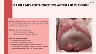 Cleft Lip and Palate: From Diagnosis to Multidisciplinary Management | PDF