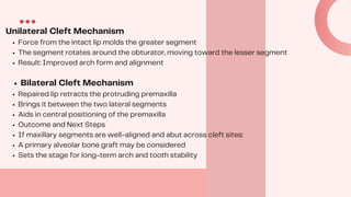 Cleft Lip and Palate: From Diagnosis to Multidisciplinary Management | PDF