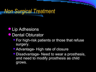 Non Surgical Treatment
Lip Adhesions
Dental Obturator
 For high-risk patients or those that refuse
surgery.
 Advantage- High rate of closure
 Disadvantage- Need to wear a prosthesis,
and need to modify prosthesis as child
grows.
 