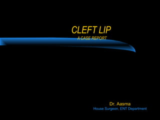 CLEFT LIP
A CASE REPORT
Dr. Aasma
House Surgeon, ENT Department
 