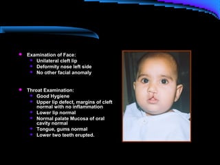  Examination of Face:
 Unilateral cleft lip
 Deformity nose left side
 No other facial anomaly
 Throat Examination:
 Good Hygiene
 Upper lip defect, margins of cleft
normal with no inflammation
 Lower lip normal
 Normal palate Mucosa of oral
cavity normal
 Tongue, gums normal
 Lower two teeth erupted.
 