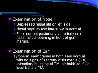 Examination of Nose
 Depressed nasal ala on left side
 Nasal septum and lateral walls normal
 Floor normal posteriorly, anteriorly oro
nasal fistula opening in front of gum
margin.
Examination of Ear
Tympanic membranes in both ears normal
with no signs of secretry otitis media ( i.e,
retraction, buldging of TM, air bubbles, fluid
level behind TM.
 