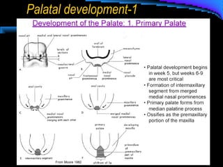 Palatal development-1
 