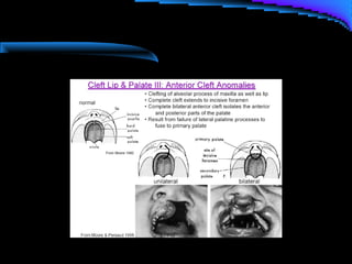 Cleft lip and palate management