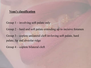 Veau Classfication Cleft lip and palate O.ppt