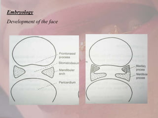 Cleft lip and palate O.ppt