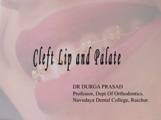 DR DURGA PRASAD
Professor, Dept Of Orthodontics.
Navodaya Dental College, Raichur.
 