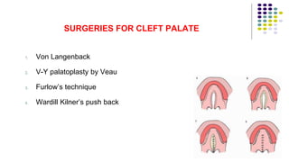 SURGERIES FOR CLEFT PALATE
1. Von Langenback
2. V-Y palatoplasty by Veau
3. Furlow’s technique
4. Wardill Kilner’s push back
103
 